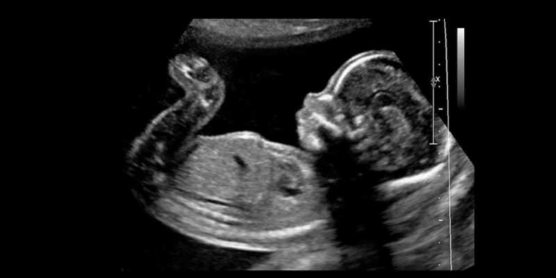 Fetal Medicine & Genetic Clinic